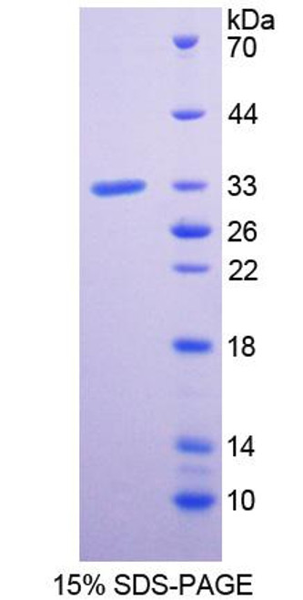 Human Recombinant Plexin A1 (PLXNA1)