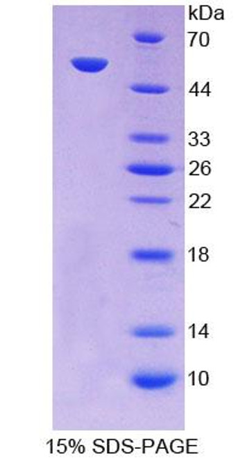 Human Recombinant Pyruvate Carboxylase (PC)