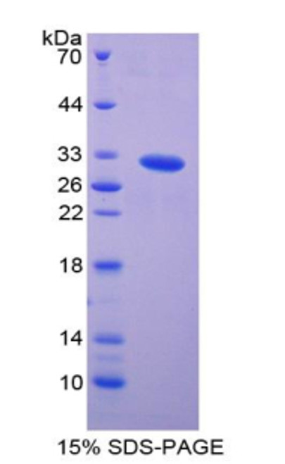 Human Recombinant p21 Protein Activated Kinase 2 (PAK2)