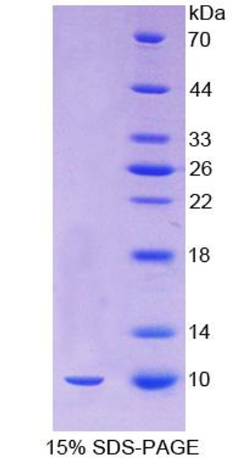 Human Recombinant Oncomodulin (OCM)