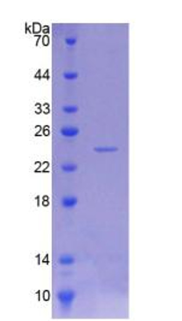 Rat Recombinant Neuropathy Target Esterase (NTE)