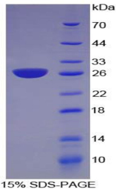 Mouse Recombinant Nicotinamide-N-Methyltransferase (NNMT)