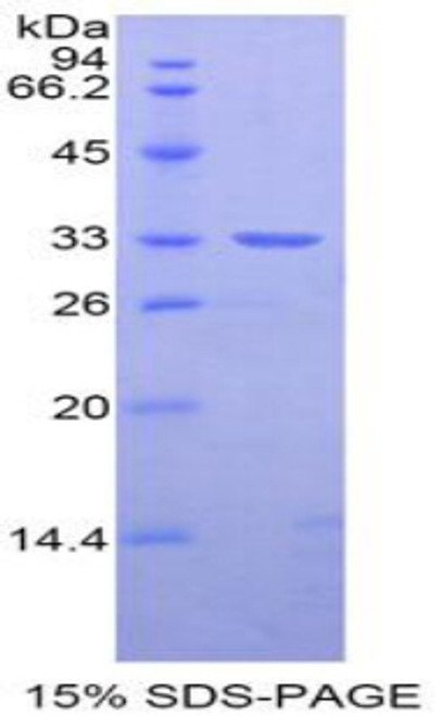 Rat Recombinant Nexilin (NEXN)