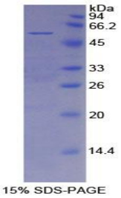 Mouse Recombinant Mesothelin (MSLN)