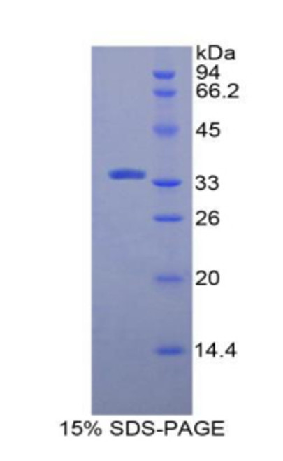 Rat Recombinant N-Methylpurine DNA Glycosylase (MPG)