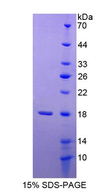 Human Recombinant Mannosidase Alpha Class 2B Member 1 (MAN2B1)