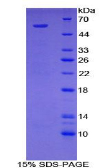 Mouse Recombinant Leucine Rich Repeat Kinase 2 (LRRK2)