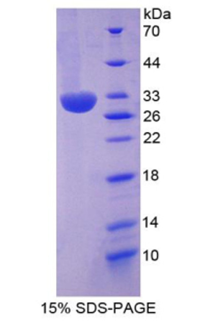 Human Recombinant Inter Alpha-Globulin Inhibitor H2 (ITIH2)