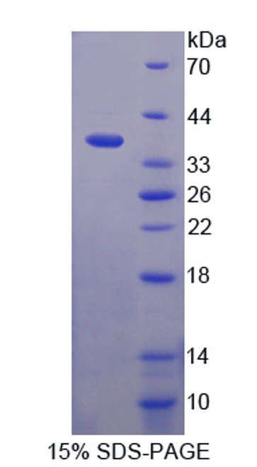 Human Recombinant Inter Alpha-Globulin Inhibitor H1 (ITIH1)