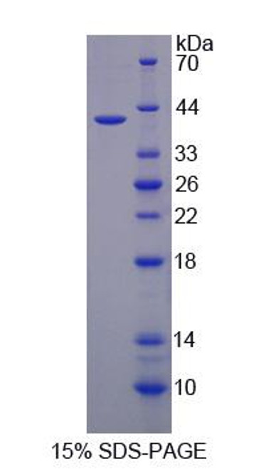 Rat Recombinant Iron Responsive Element Binding Protein 2 (IREB2)