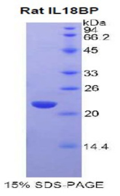 Rat Recombinant Interleukin 18 Binding Protein (IL18BP)