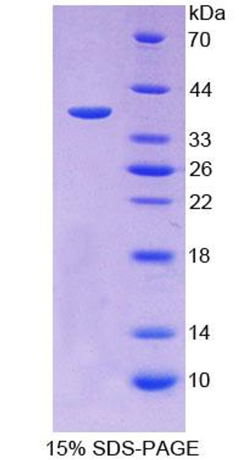 Human Recombinant Iduronidase Alpha L (IDUa)