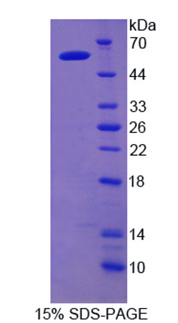 Rat Recombinant Iduronate-2-Sulfatase (IDS)