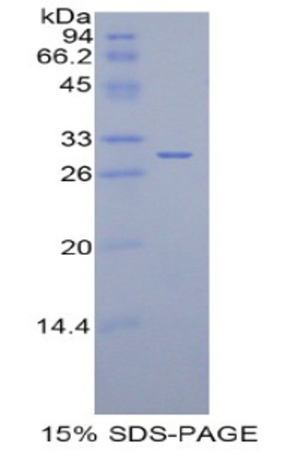 Rat Recombinant Isocitrate Dehydrogenase 1, Soluble (IDH1)