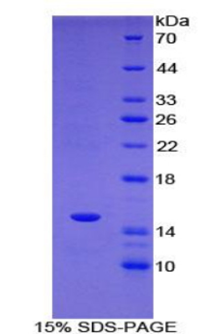 Rat Recombinant T-Box Protein 3 (TBX3)