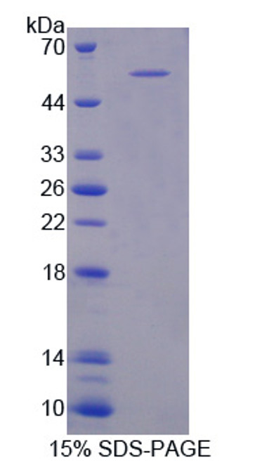 Mouse Recombinant Pleckstrin Homology Domain Containing Family A, Member 1 (PLEKHA1)