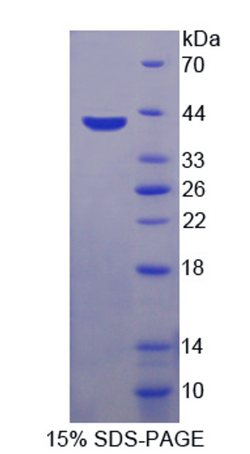 Human Recombinant Glycosylphosphatidylinositol Specific Phospholipase D1 (GPLD1)