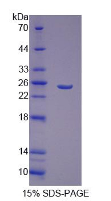 Mouse Recombinant Growth Factor, Augmenter Of Liver Regeneration (GFER)