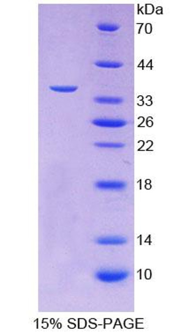 Human Recombinant Follistatin Like Protein 1 (FSTL1)