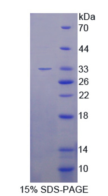 Mouse Recombinant Feline Sarcoma Oncogene (FES)