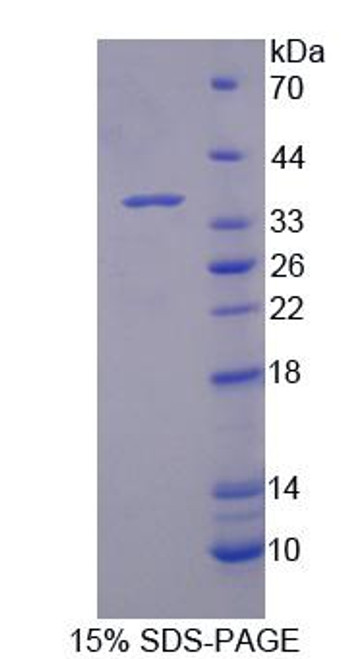 Human Recombinant Dynein, Axonemal, Heavy Chain 11 (DNAH11)