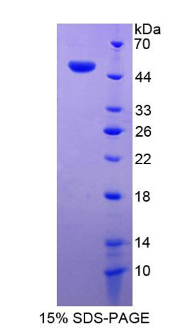 Human Recombinant Destrin (DSTN)