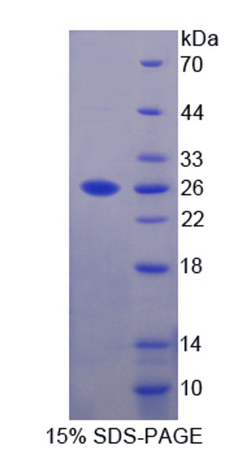 Mouse Recombinant Epiphycan (EPYC)