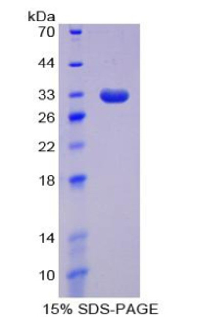 Human Recombinant DNA Methyltransferase 1 (DNMT1)