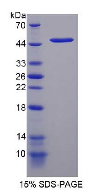 Mouse Recombinant DNA Damage Inducible Transcript 3 (DDIT3)