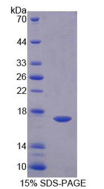 Human Recombinant GABA-A Receptor Associated Protein Like Protein 2 (GABARAPL2)