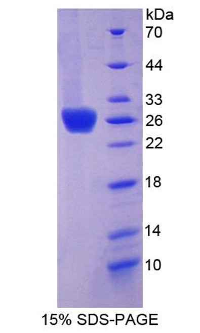 Human Recombinant Coxsackie Virus And Adenovirus Receptor (CXADR)