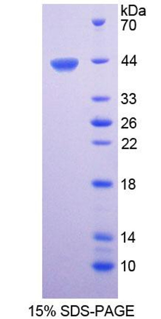 Human Recombinant Di-N-Acetyl Chitobiase (CTBS)