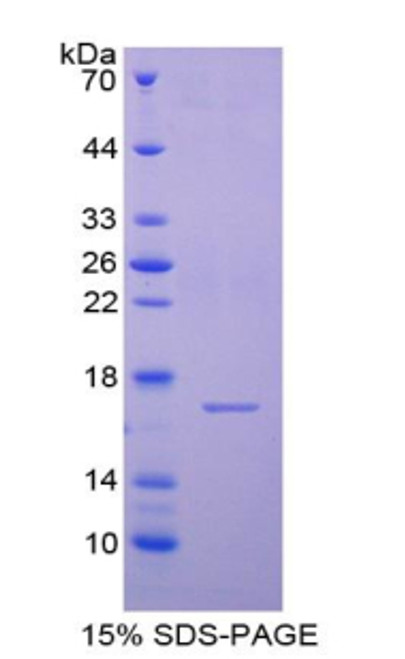 Human Recombinant Cystatin 6 (CST6)