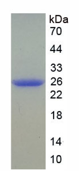 Mouse Recombinant Catechol-O-Methyltransferase (COMT)