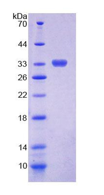 Human Recombinant Chitinase 1 (CHIT1)