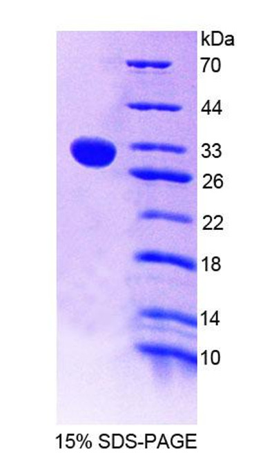 Mouse Recombinant Chitinase 1 (CHIT1)