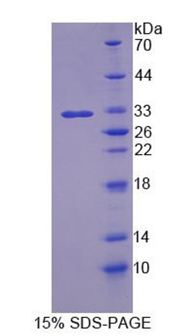 Human Recombinant BMP Binding Endothelial Regulator (BMPER)