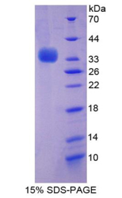 Human Recombinant Beclin 1 (BECN1)