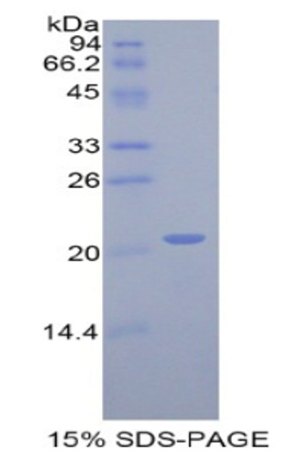 Rat Recombinant Actin Related Protein 2/3 Complex Subunit 4 (ARPC4)