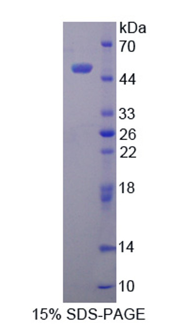 Human Recombinant Translocator Protein (TSPO)