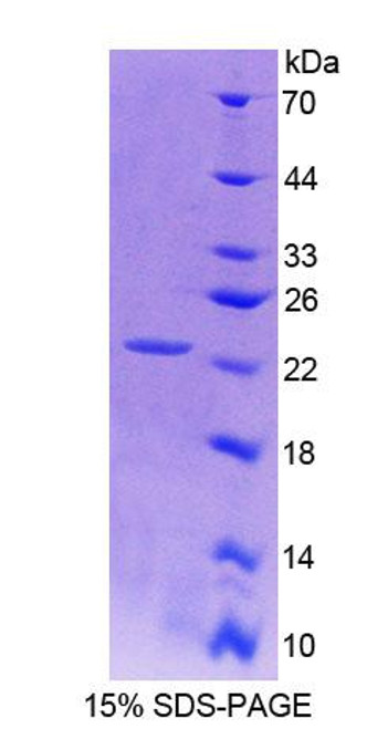 Rat Recombinant Von Hippel Lindau Tumor Suppressor (vHL)