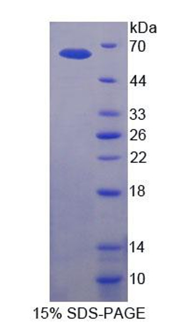 Human Recombinant Inhibitor Of Kappa-Light Polypeptide Gene Enhancer In B-Cells Kinase Beta (IkBKb)