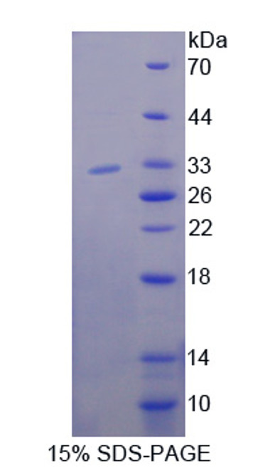 Human Recombinant Phosphoinositide-3-Kinase Adaptor Protein 1 (PIK3AP1)