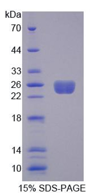 Rat Recombinant Rho Guanine Nucleotide Exchange Factor 7 (ARHGEF7)