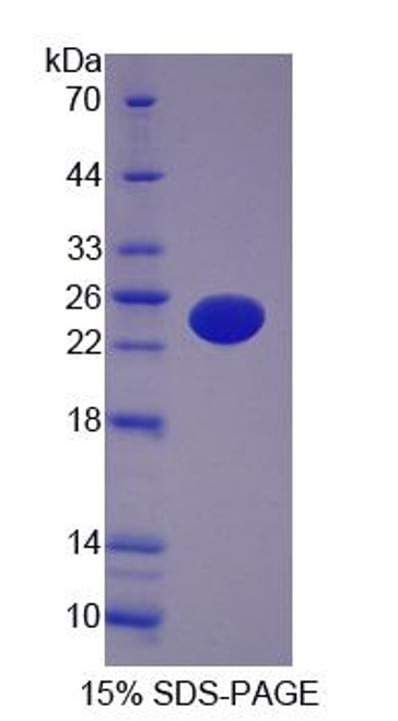 Human Recombinant AF4/FMR2 Family, Member 1 (AFF1)