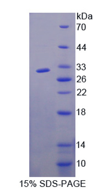 Human Recombinant F-Box And WD Repeat Domain Containing Protein 7 (FBXW7)
