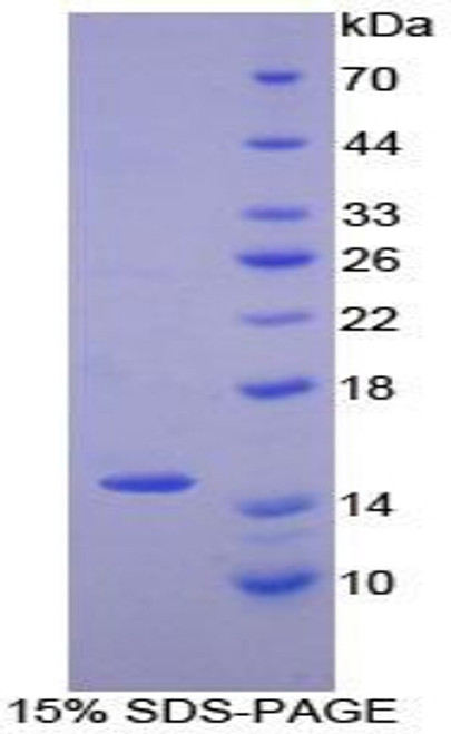 Human Recombinant Numb Homolog (NUMB)