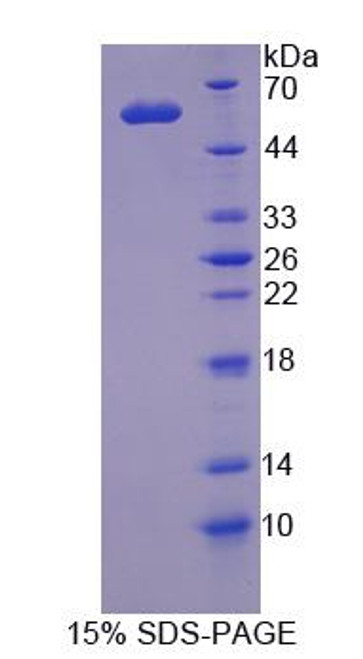 Human Recombinant Meiotic Recombination 11 Homolog A (MRE11A)