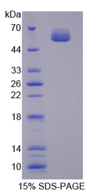 Human Recombinant L-Threonine Dehydrogenase (TDH)