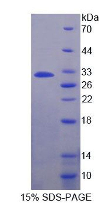 Human Recombinant A Disintegrin And Metalloprotease 22 (ADAM22)